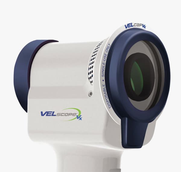 Clinician using a VELscope device for oral cancer screening.